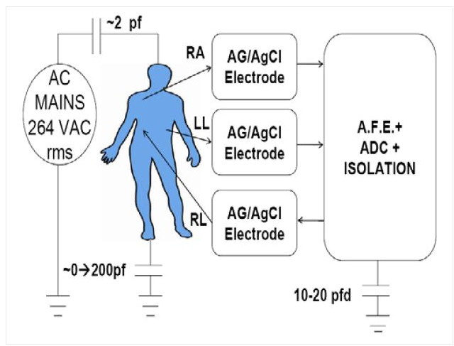 專(zhuān)家話語(yǔ)：如何應(yīng)對(duì)ECG（心電圖）設(shè)計(jì)的六大挑戰(zhàn)？