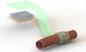 斯坦福大学开发新型可降解血流传感器 可检查血管是否堵塞